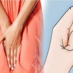 5 Penyebab Keputihan Berwarna Kuning saat Hamil Tua